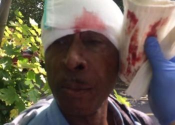 70-Year-Old Black Man Hospitalised Following Police Arrest In South East London