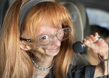 Adalia Rose Williams, YouTuber Who Had Rare Genetic Condition, Dead at 15