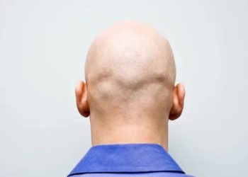U.K. Employment Ruling Determines Calling a Man ‘Bald’ Is Sexual Harassment