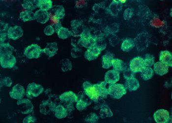 Iowa Beach Closed After Swimmer Infected With Brain-Eating Amoeba