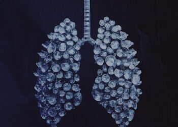 Roddy Ricch Shares “Stop Breathing” Single