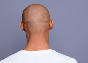 According To A New Study, Men Who Drink Energy Drinks Risk 42% Chance Of Hair Loss