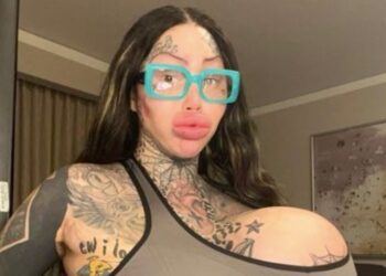 Instagram Model Goes Viral After Revealing Her 38J Breast Implant Popped