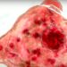 Florida Health Officials Investigating After Person Dies From Rare Brain-Eating Amoeba Infection