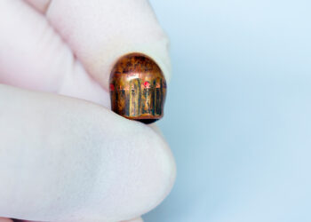 Woman Gets Bullet Surgically Removed From Clitoris Following Accidental Shooting