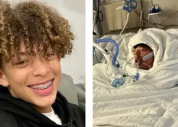 16-Year-Old TikToker Gets 75 Percent of Body Burned After Makeshift Torch Explodes